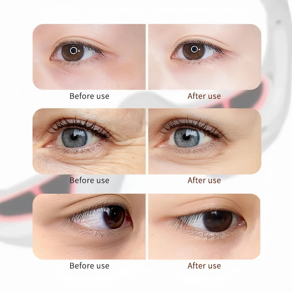 Dispositivo de terapia con luz roja para ojos
