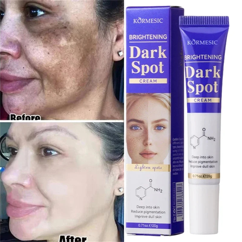 Crema Iluminadora para Manchas
