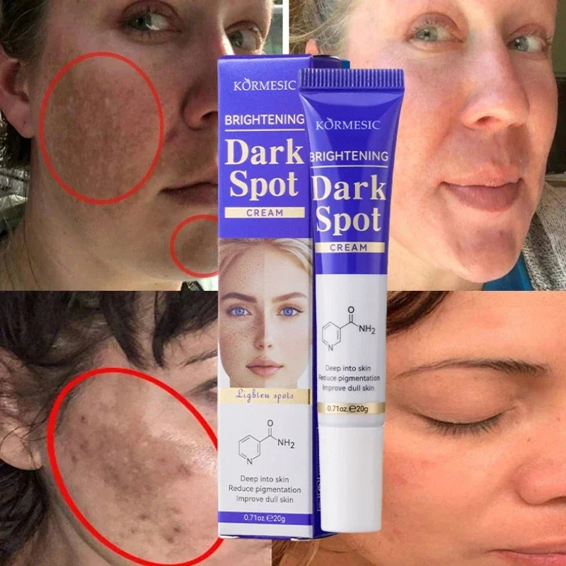 Crema Iluminadora para Manchas